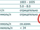 Помогите разобраться в результате анализа
