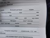 УЗИ тахикардия