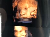 3-D фото 29 недель.