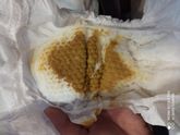 Понос у малыша в полтора месяца