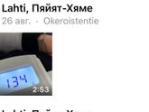 Фетальный допплер
