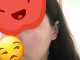 Девочки сегодня лицо покрылось