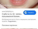 Верхние зубы