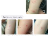 Девочки, на что похоже??