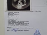 В субботу ходила на