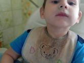 Синий носогубный треугольник
