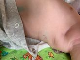 Гемангиома или что то другое?