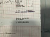 Девочки расскажите все ли