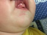 Девочки! Это зубы скоро??? Или нет? (Фото)