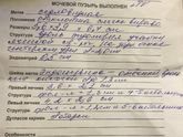 Через сколько овуляция после положительного теста ?