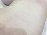 Атоп. Дерматит❌ кто в теме эмолентов , помогите советом