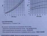Стоит переживать ?