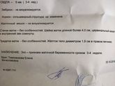 Девочки 3-4 недели,это срок