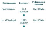 Переодисеские боли внизу живота.