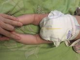 Был приём у ортопеда