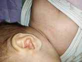 Аллергия? Цветение? Потнички?