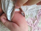 Девочки,это аллергия или опрелости?Краснота