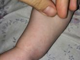 И так по всему телу.. Кто подскажет?