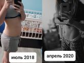 Диастаз и пупочная грыжа