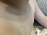 Потница или посерьезней?