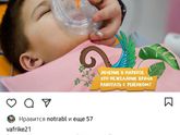 Лечение молочных зубов под наркозом.