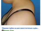 Девочки кто колол липолитики