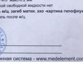Об овуляции, о тестах на овуляции, обо всем