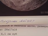 УЗИ на маленьком сроке