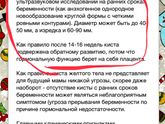 Киста?