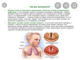 Ложный круп