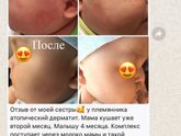 Аллергия, как забеременеть или какие витамины лучше выбрать