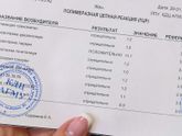 Ураплпзма