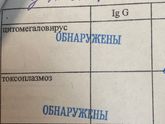 Токсоплазмоз