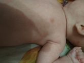 Девочки подскажите аллергия или