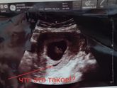 Что это такое?есть тут кто то кто шарит в узи?