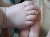 кто сталкивался с белыми пятнами на коже грудничка, не подскажите??
