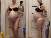 37 недель. Отеки! Как бороться?