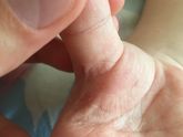 Девочки, у ребёнка одна