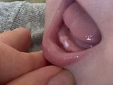 Вот они родимые 🦷
