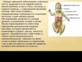 галактоза