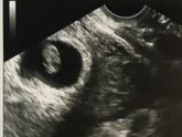 Фотографии: живот на 8 неделе беременности