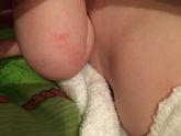 Может у кого из малышей такое было