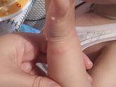Появились вчера такие пятнышки