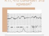 Что показывает КТГ