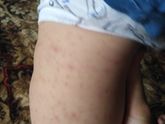 Девочки, подскажите, у нас
