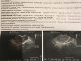 Кто разбирается в узи