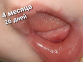 Зубыыыыыы!!!