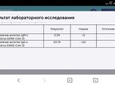 Полторы недели после второй прививки от короновируса.