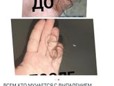 1,5 года выпадают волосы! Что делать?
