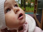Какие-то пятная на лице. Фото в коммент
